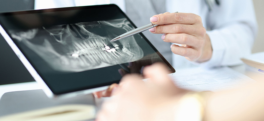 領航歐美全數字化口腔設備，洞悉口腔數據清晰成像，從源頭避免數據誤差，提高口腔診療安全性。